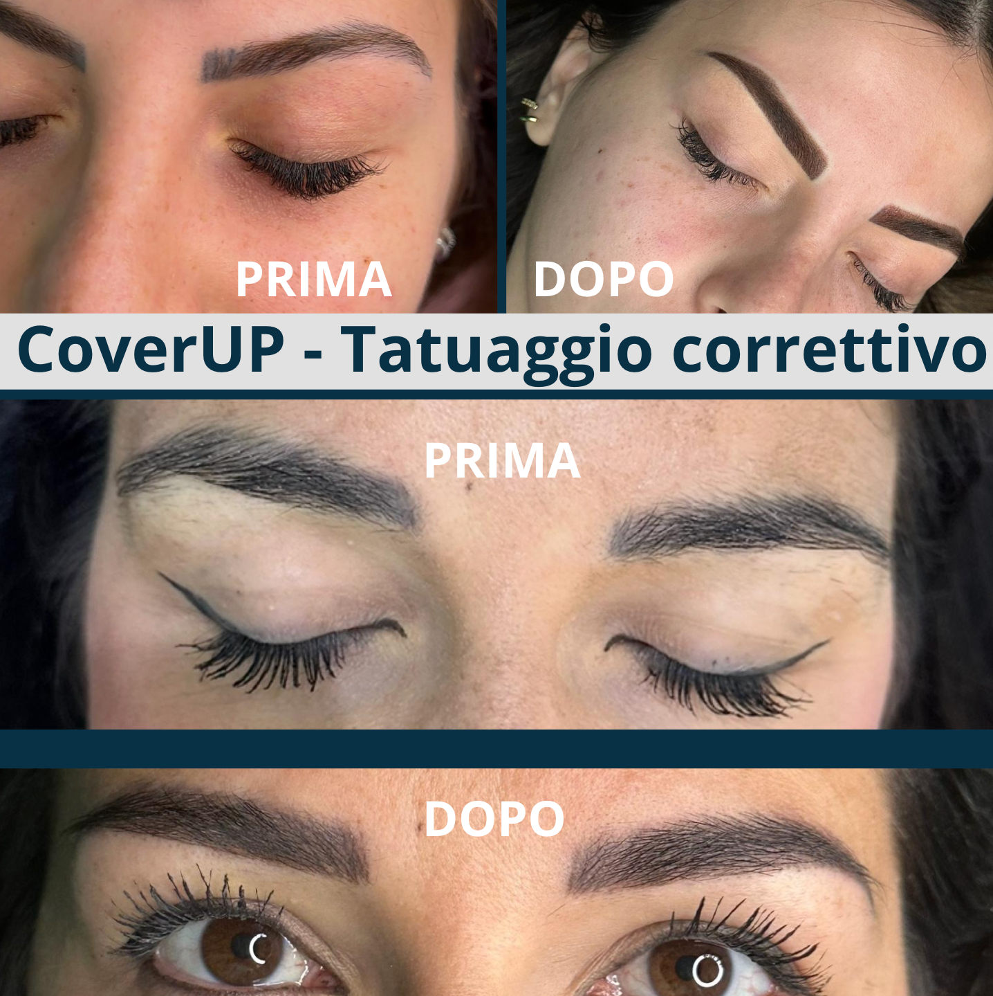 Acquista il tuo trattamento